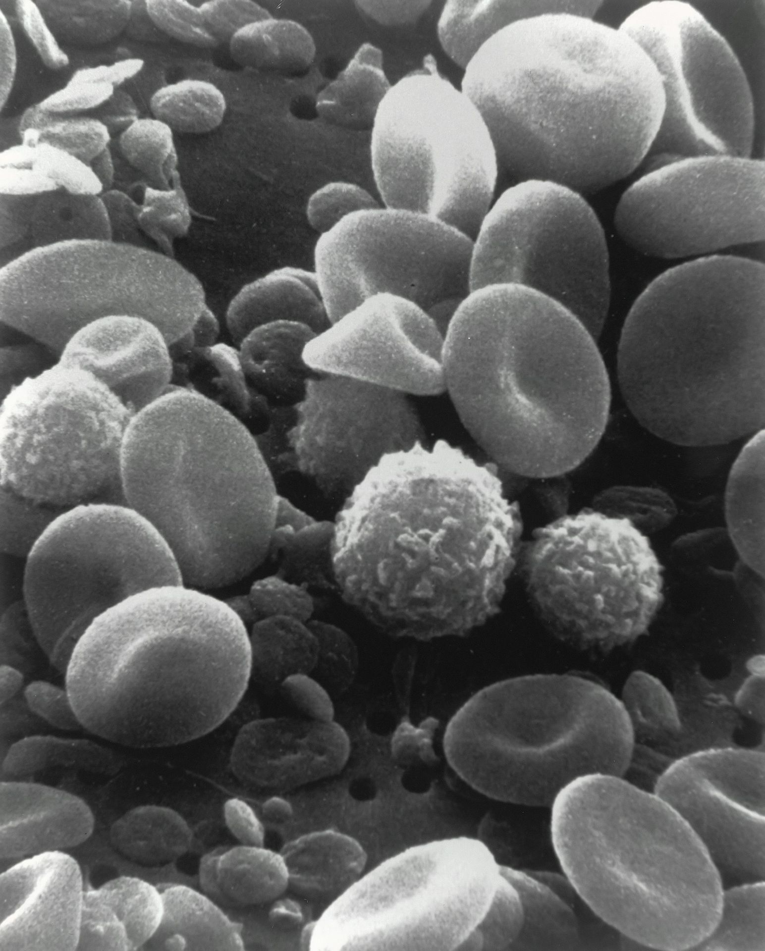 Blood cells